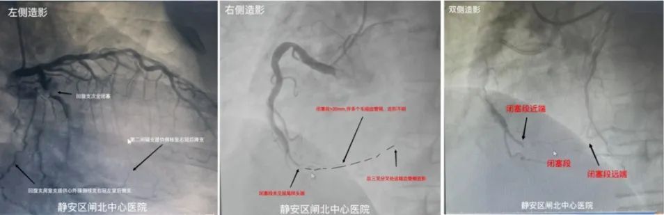 e30cef9f-8210-4318-ae39-b3978e5f05ae.jpg